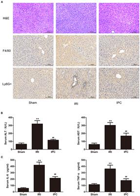 Circular RNA Microarray Analyses in Hepatic Ischemia-Reperfusion Injury With Ischemic Preconditioning Prevention
